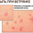 ветрянка 2.jpg - Елецкая ГДБ