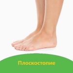 ПЛОСКОСТОПИЕ