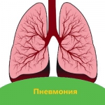 ПНЕВМОНИЯ