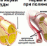 diabeticheskaya-polineyropatiya2.jpg - Елецкая ГДБ