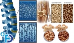 osteopenia.jpg