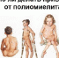ПОЛИОМИЕЛИТ - Елецкая ГДБ