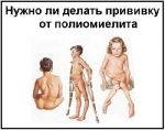 ПОЛИОМИЕЛИТ