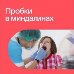 Пробки в миндалинах