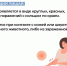 Чем можно заразиться от кошек ? - Елецкая ГДБ